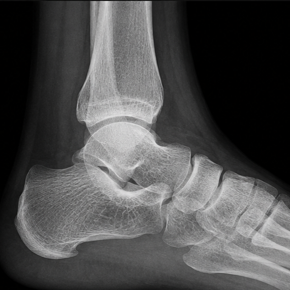 Foot and ankle surgery