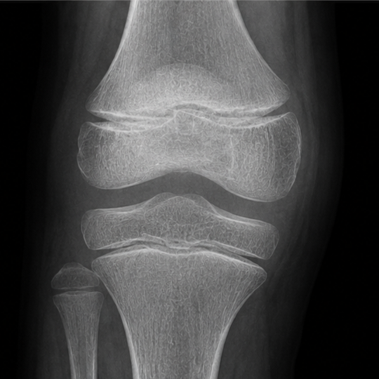Children's orthopaedic care