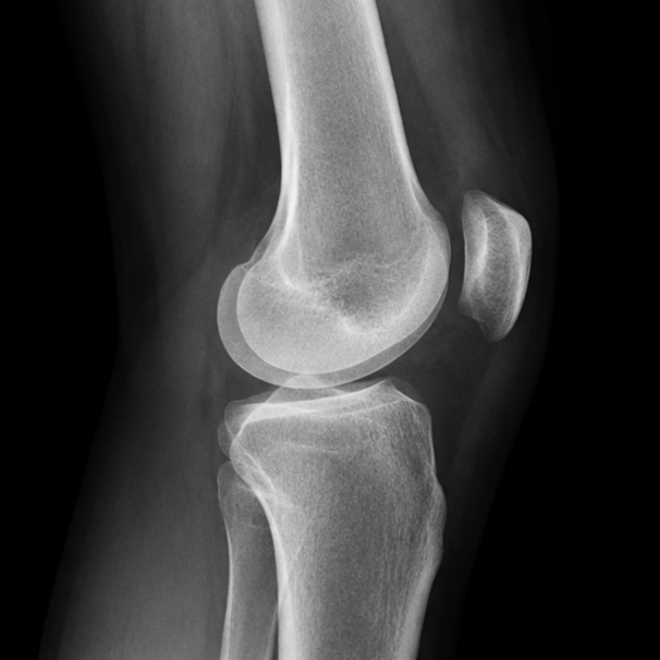 Knee replacement and ligament surgery