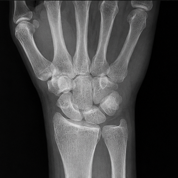 Hand and wrist surgery